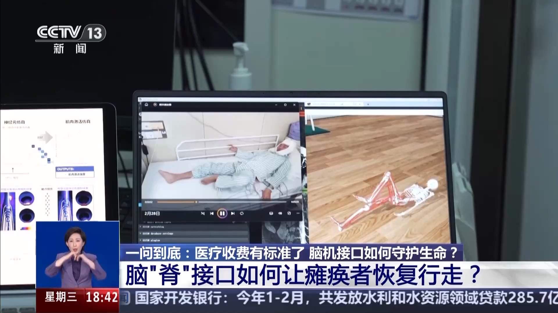 科幻照进现实，脑机接口如何守护生命？