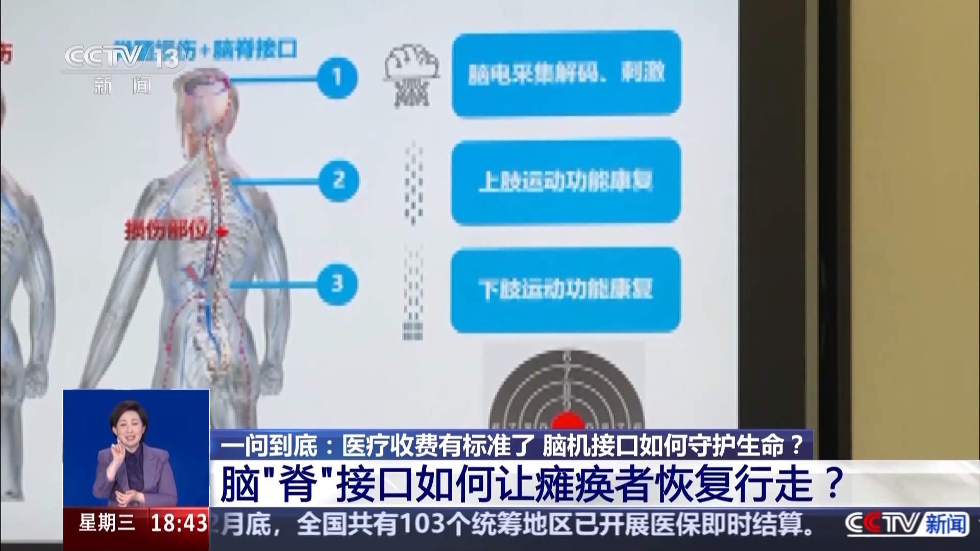 科幻照进现实，脑机接口如何守护生命？